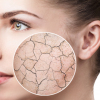 Dry Skin: Causes, Symptoms and Natural Remedies