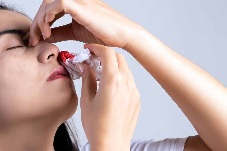 nosebleed-young-woman-with-bloody-nose